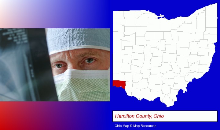 a physician viewing x-ray results; Hamilton County, Ohio highlighted in red on a map