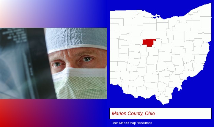 a physician viewing x-ray results; Marion County, Ohio highlighted in red on a map