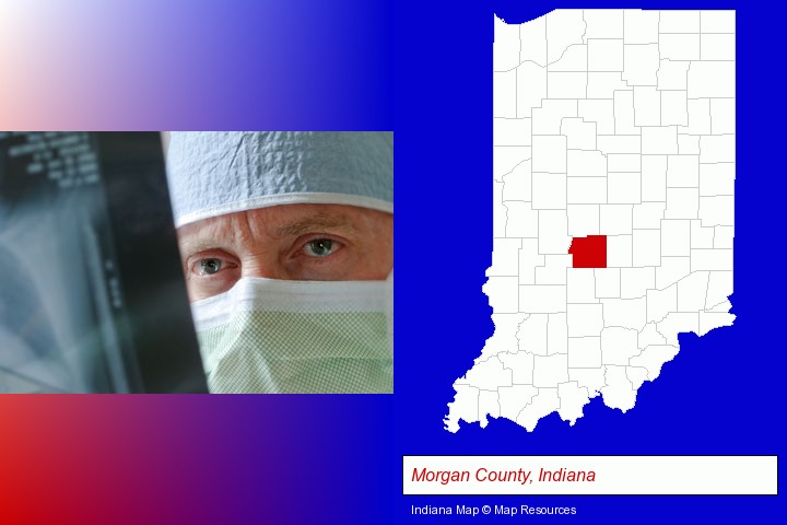 a physician viewing x-ray results; Morgan County, Indiana highlighted in red on a map