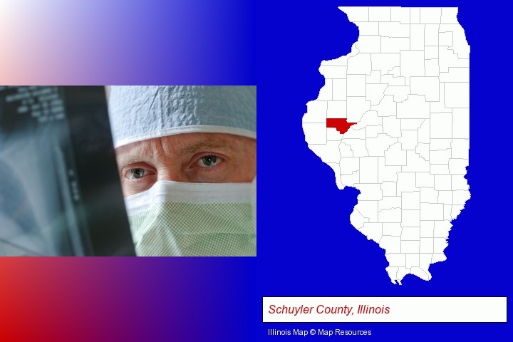 a physician viewing x-ray results; Schuyler County, Illinois highlighted in red on a map